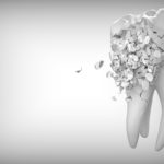 Czy można uratować złamany ząb?