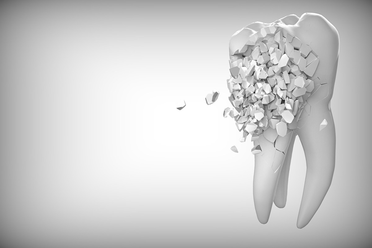 Czy można uratować złamany ząb?