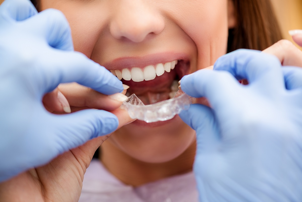 Czym jest płytka retencyjna w leczeniu ortodontycznym?