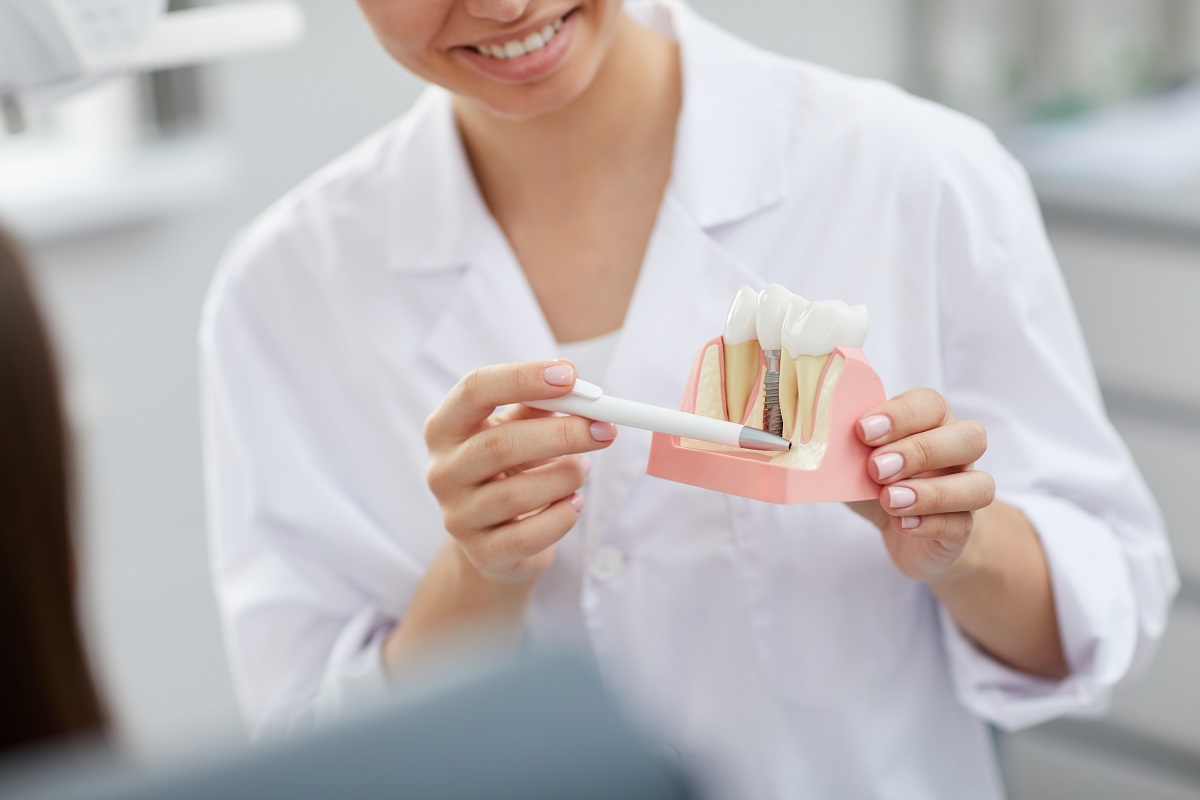 Dlaczego warto zainwestować w implanty zębów?