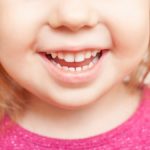 Białe plamy na zębach u dziecka – co to jest?