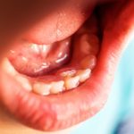 Ząb rośnie na dziąśle u dziecka – co robić?